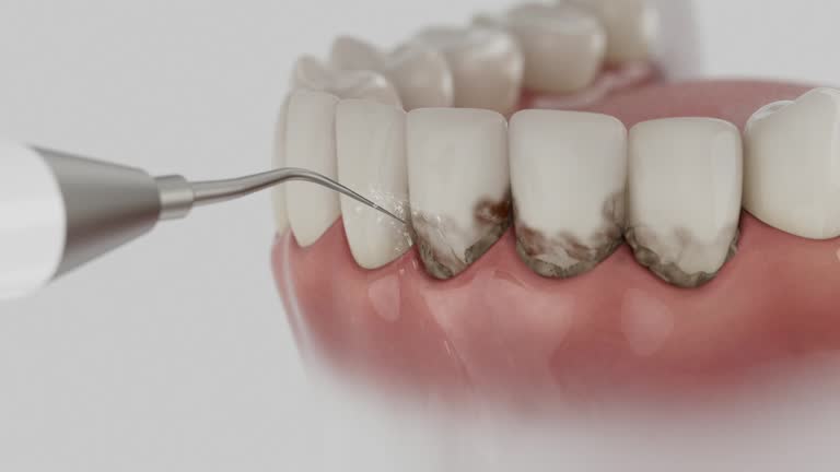 Trusted Wisdom Tooth Removal service in Strasburg, CO - Dentist Open Now